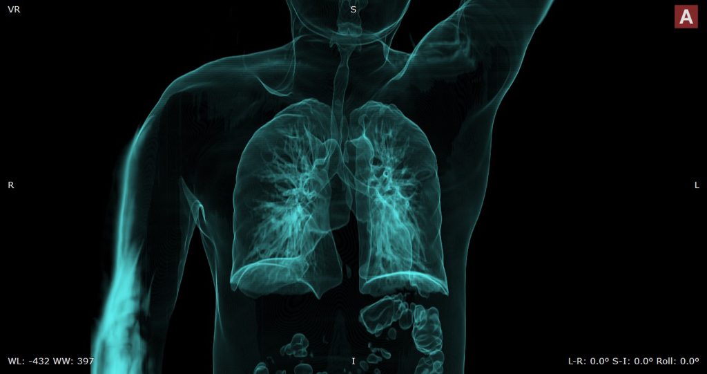 fisiologia-respiratoria-e-parametros-do-ventilador